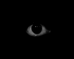 Scopophobia